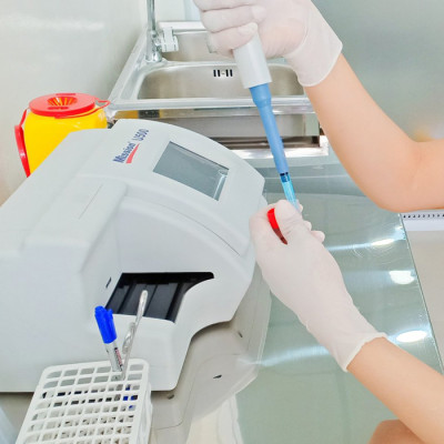 Gói khám tầm soát biến chứng bệnh tiểu đường tại phòng khám đa khoa quốc tế Golden Healthcare