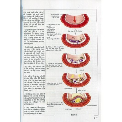 Sách - Giải phẫu bệnh học 2022