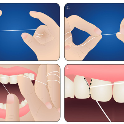Chỉ nha khoa hương Lô hội Pierrot 50m