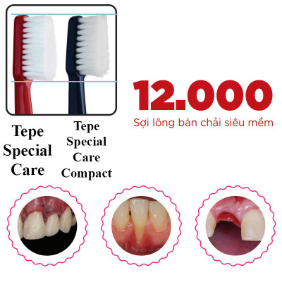 Bàn chải đánh răng siêu mềm màu đỏ - dùng sau phẫu thuật răng miệng Tepe Special Care (vỉ)