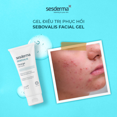 Gel dưỡng phục hồi Sesderma Sebovalis Facial cho da dầu 50ml