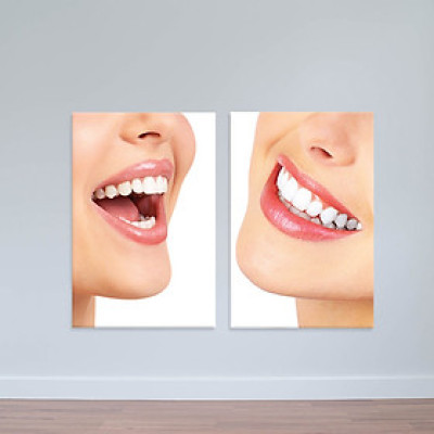 Bộ 2 tranh Răng sứ hoàn mỹ | Tranh đẹp phòng nha W2023