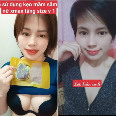 Liệu trình 5h kẹo mầm sâm tố nữ xmax Mychi - vua nở ngực - nữ hoàng nội tiết