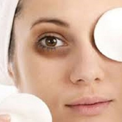 KEM CHỐNG NHĂN, LÀM GIẢM THÂM VÙNG MẮT HẠNH NHÂN MẸ KEN