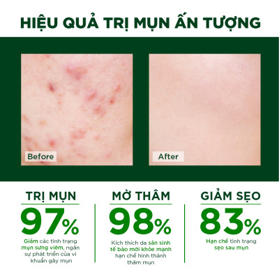 Kem Hỗ Trợ Giảm Mụn Ngừa Thâm Liền Sẹo Ori