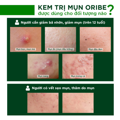 Kem Hỗ Trợ Giảm Mụn Ngừa Thâm Liền Sẹo Ori