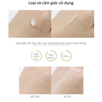 DƯỠNG ẨM BAN NGÀY NOTS 28 REMEDY BALANCING DAY MOISTURIZER