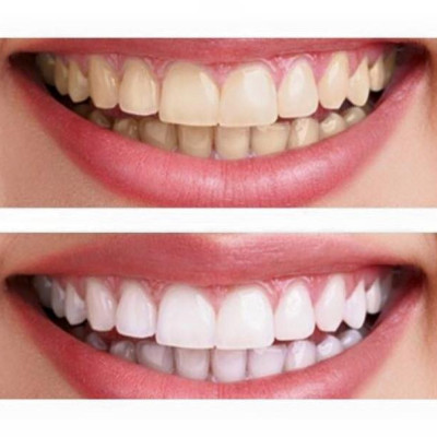 Combo kem đánh răng 62g và bột tẩy trắng răng Eucryl 50g (Chính hãng)